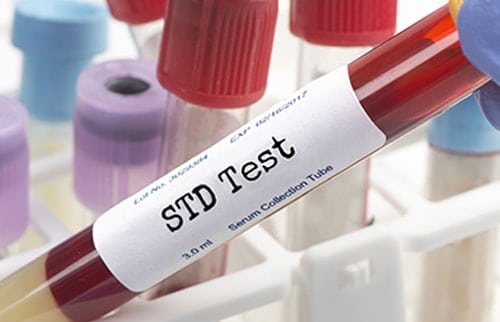 STD Treatment